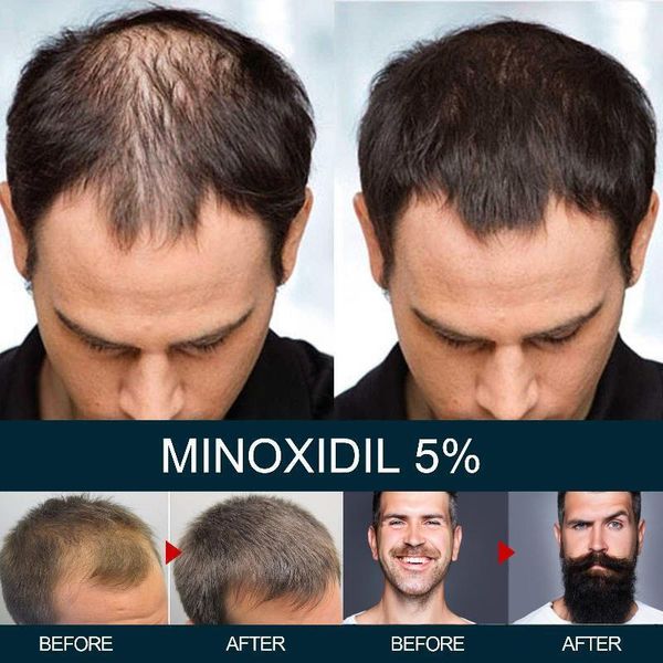 Піна minoxidil 5% KIRKLAND (1 флакон) 4 фото