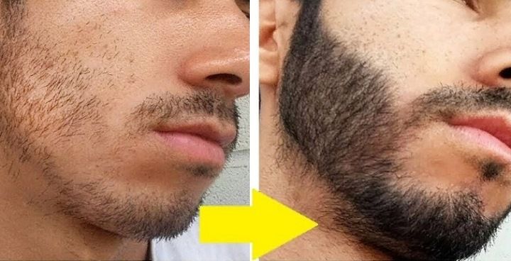 Пена minoxidil 5% KIRKLAND (1 флакон) 4 фото